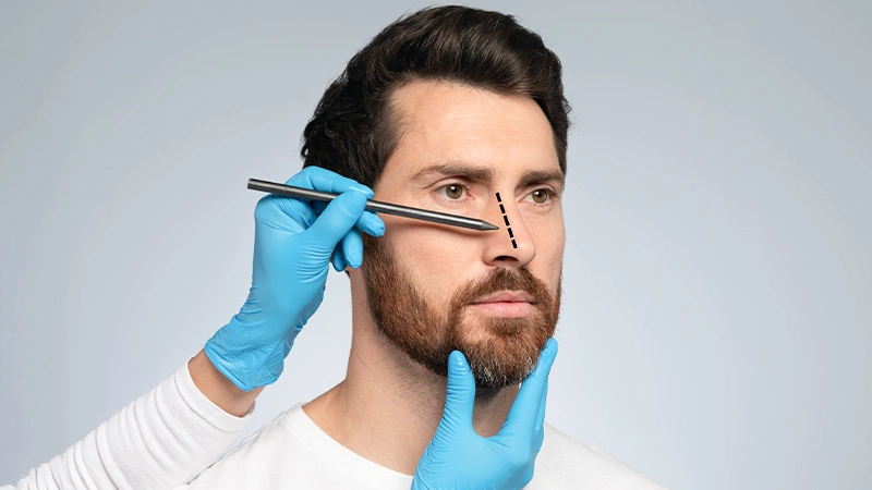 Best Non-Surgical Alternatives to Rhinoplasty in Turkey